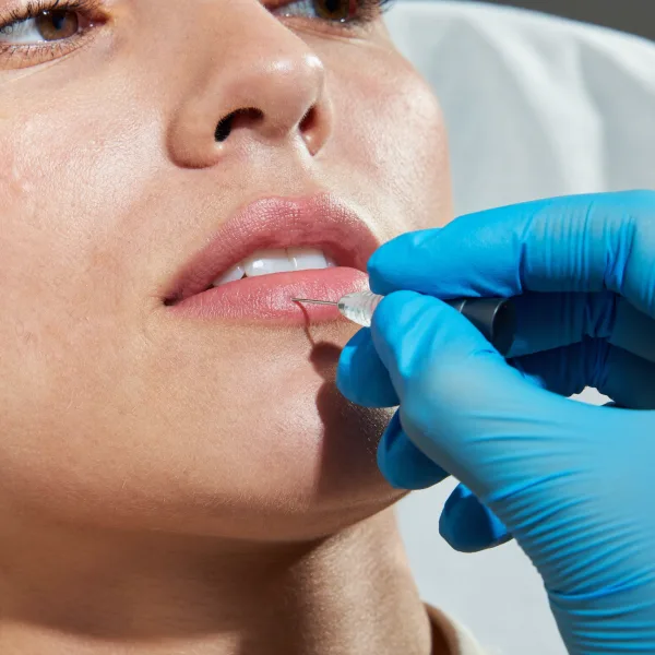 Lippen aufspritzen (1 ml)